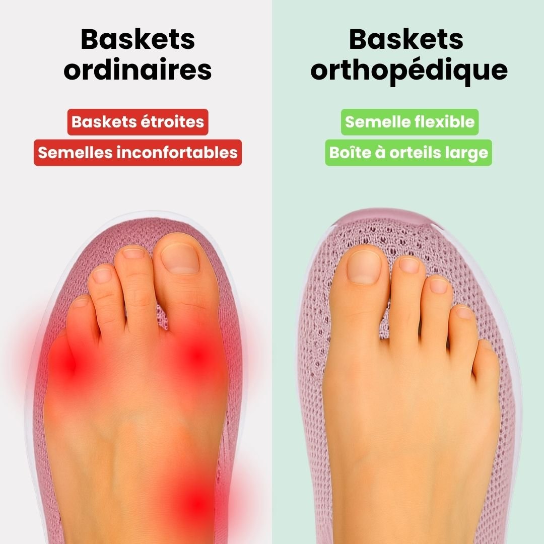 Damskie buty sportowe ortopedyczne w kolorze ciemnoszarym, nowoczesny styl i wygodne podeszwy, elegancki widok z boku.